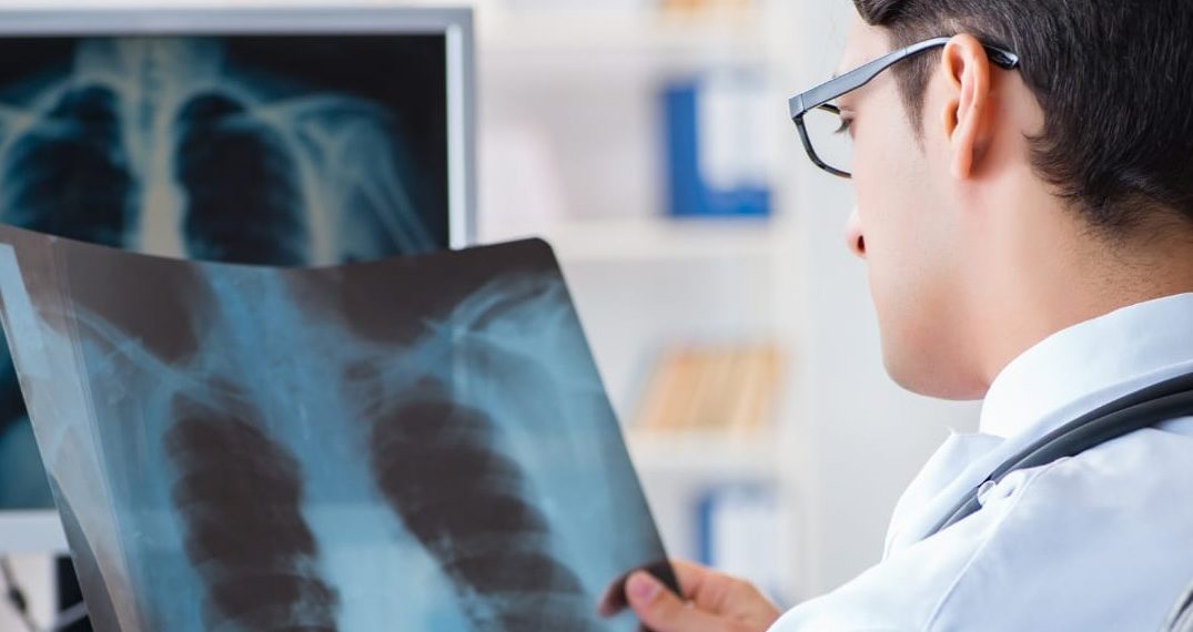 Agosto Branco alerta para o câncer de pulmão