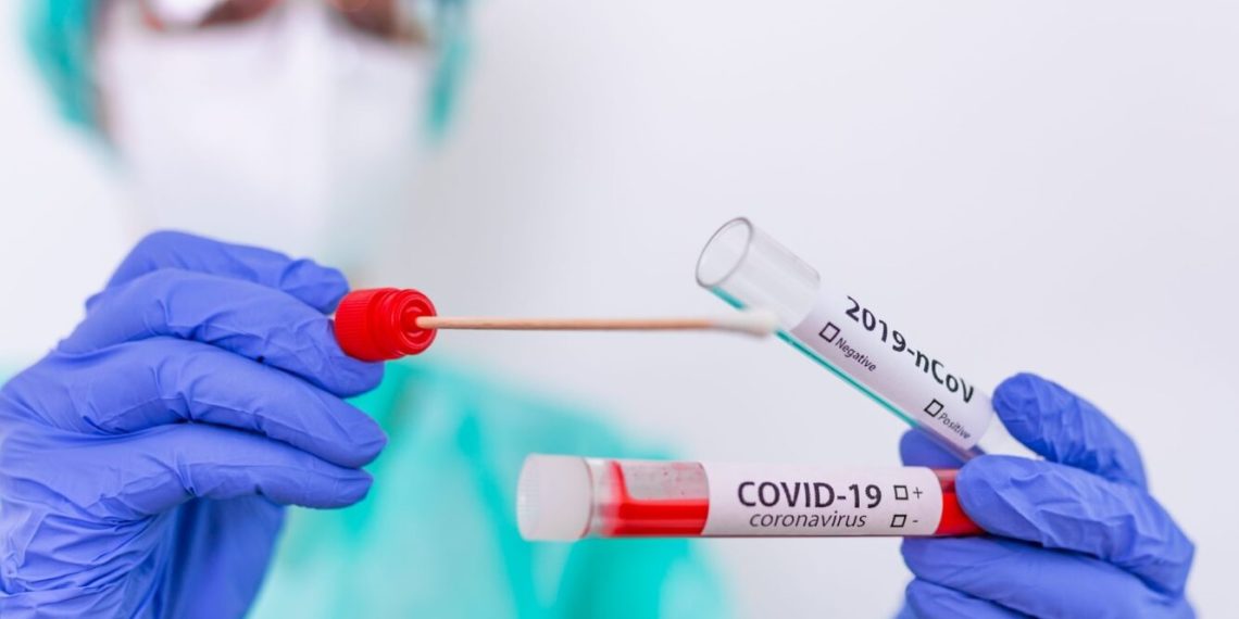 Registrada queda de 90% nos casos de Covid-19 no Piauí