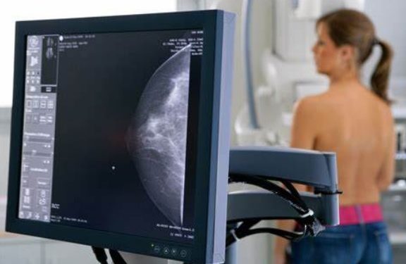 Especialista fala sobre a importância do diagnóstico precoce do câncer de mama