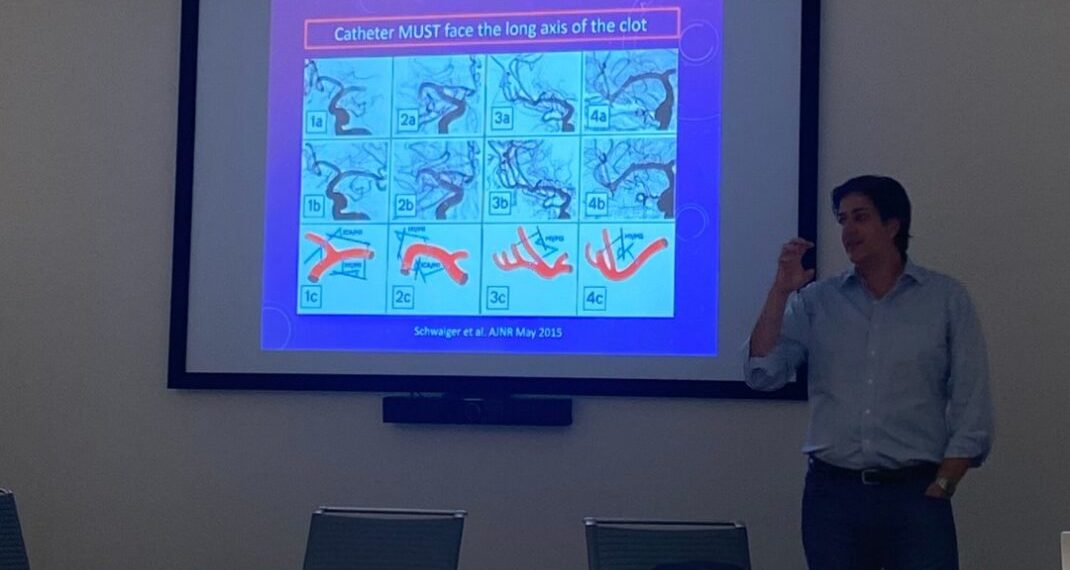 Experiência do HGV em trombectomia mecânica é apresentada nos EUA