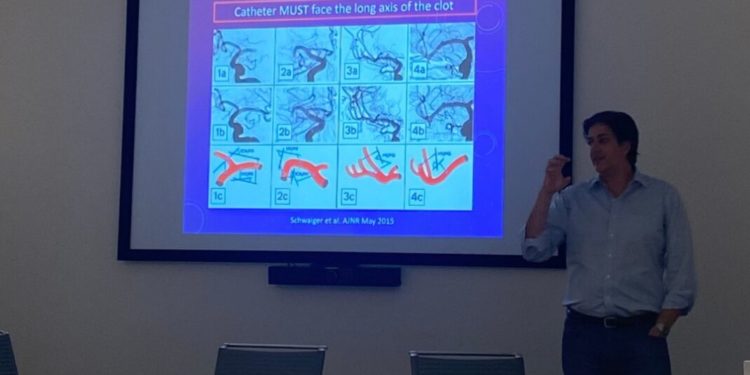 Experiência do HGV em trombectomia mecânica é apresentada nos EUA